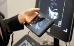 iVIZ سونوسایت جدید، اولتراساوند قابل حمل، روانه بازار اروپا شد