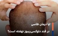 آیا درمان طاسی در قند دئوکسی‌ریبوز نهفته است؟